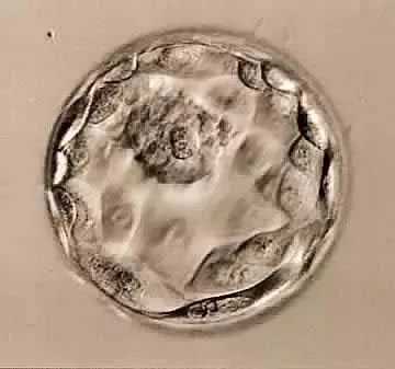 武汉代孕小孩-2022年去哪里找代孕的女子_为什么我试管移植的是囊胚还是不能成