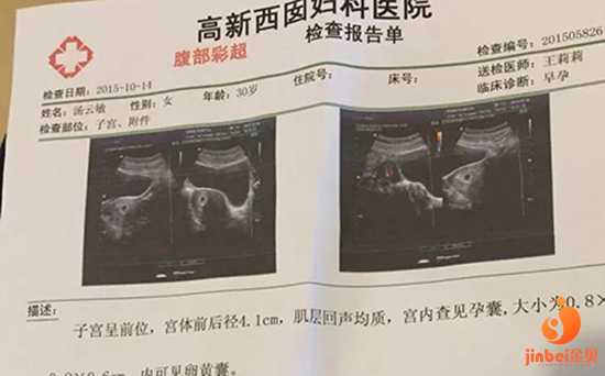 武汉医院供卵-代孕一个孩子至少多少钱_【哪里有做供卵试管的医院】望孕妈妈