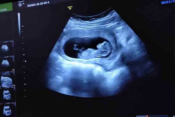 武汉专业的助孕包成功-哪里有招代孕_怀孕几个月能看出男孩女孩？